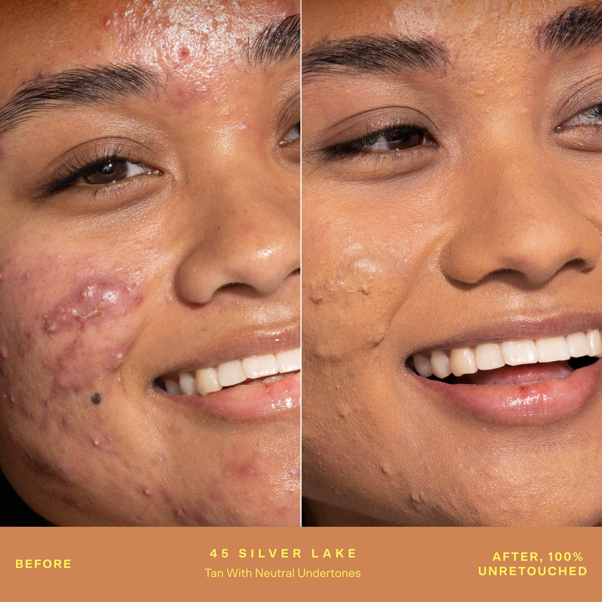 SunnyDays™ Tinted SPF 30 B6