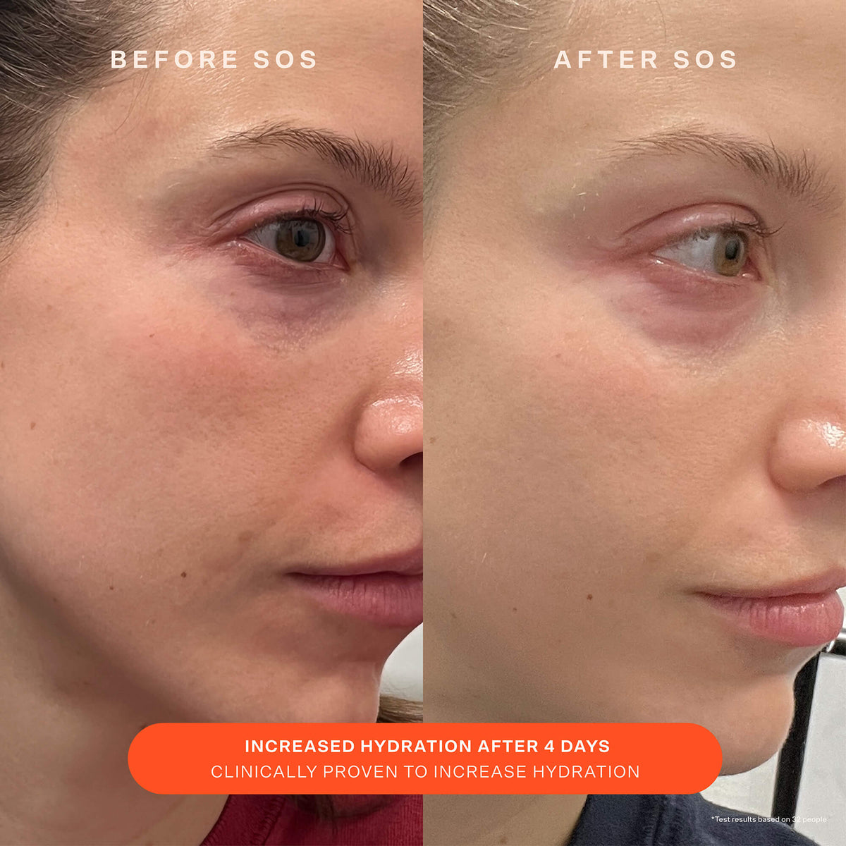 SOS Recovery Cream A4