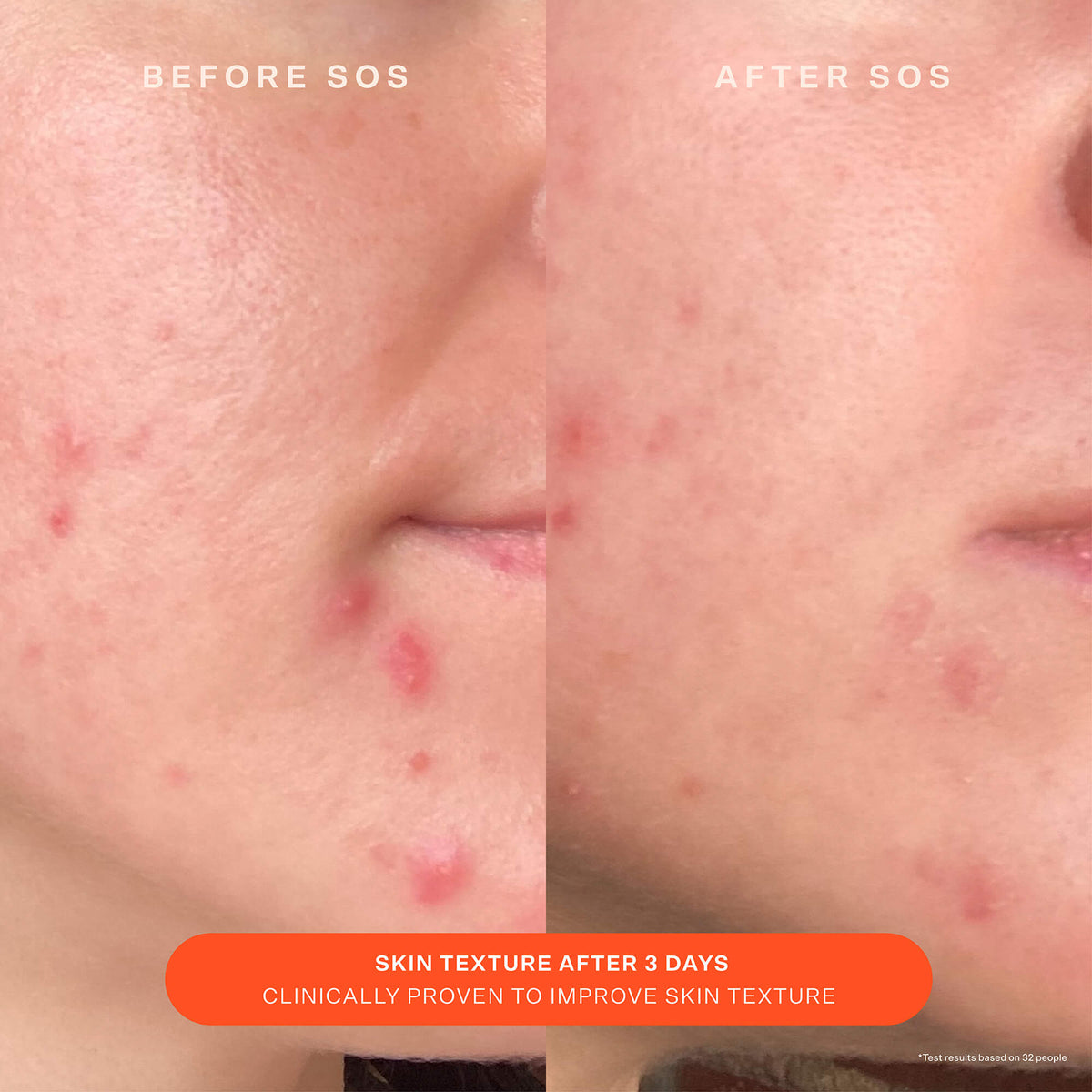 SOS Recovery Cream A4