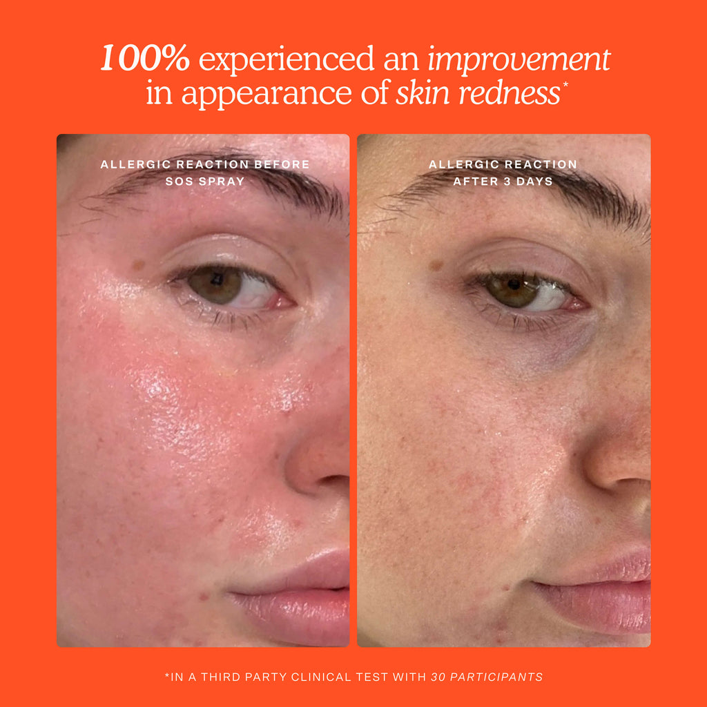 SOS 3-Step Skincare Set O3