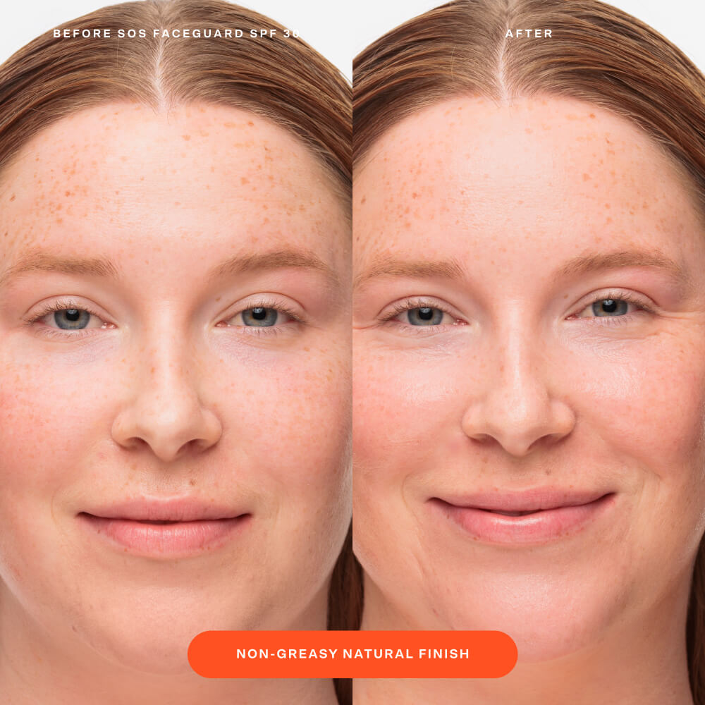 SOS FaceGuard™ SPF 30 Sunscreen PA+++ R1