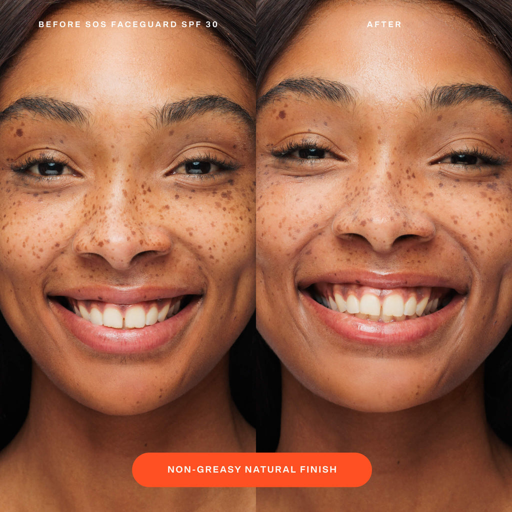 SOS FaceGuard™ SPF 30 Sunscreen PA+++ E5