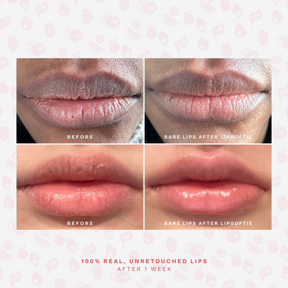LipSoftie® Lip Treatment Set W4