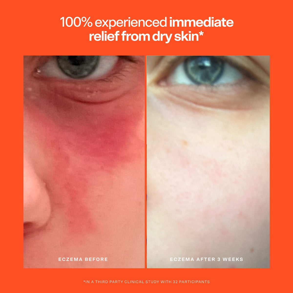SOS Rescue Serum K4