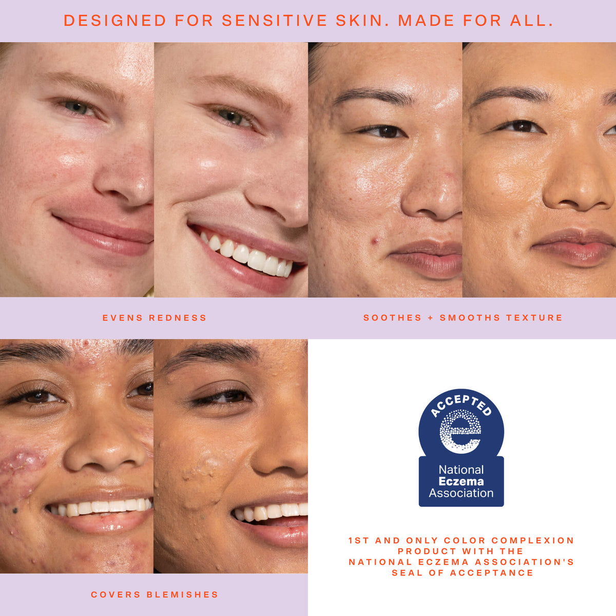 SunnyDays™ Tinted SPF 30 B6