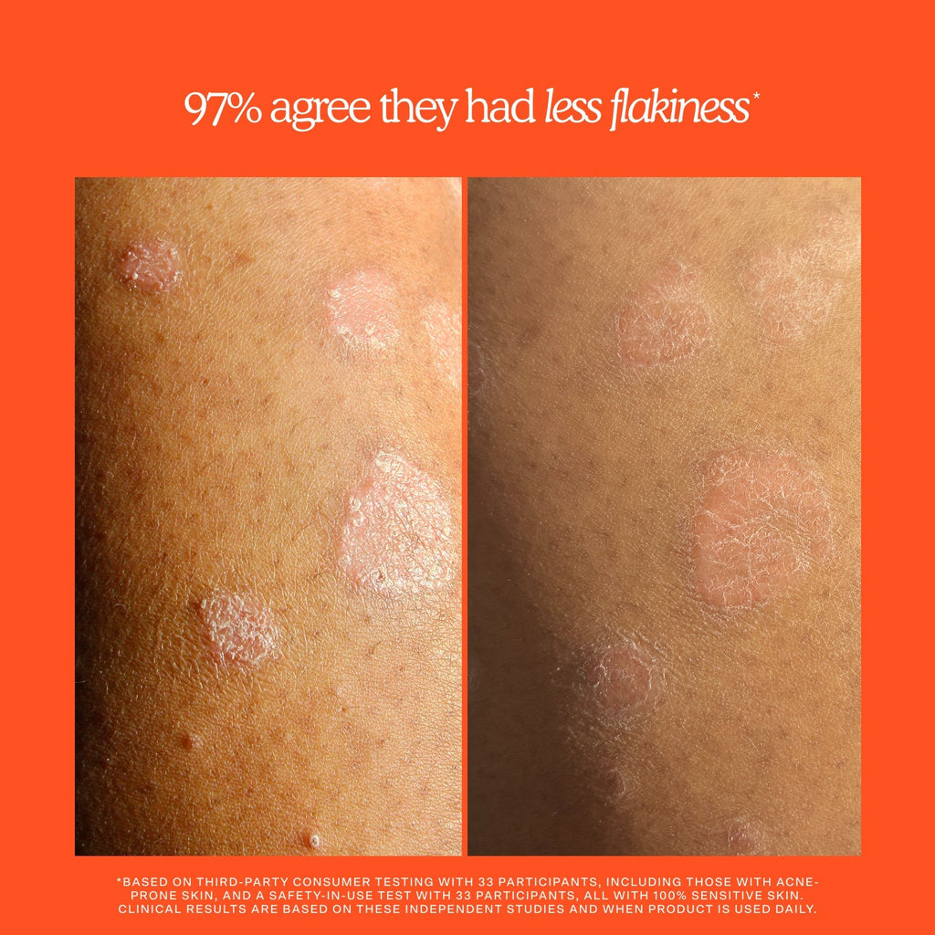 SOS Rescue + Relief Body Wash Treatment T6