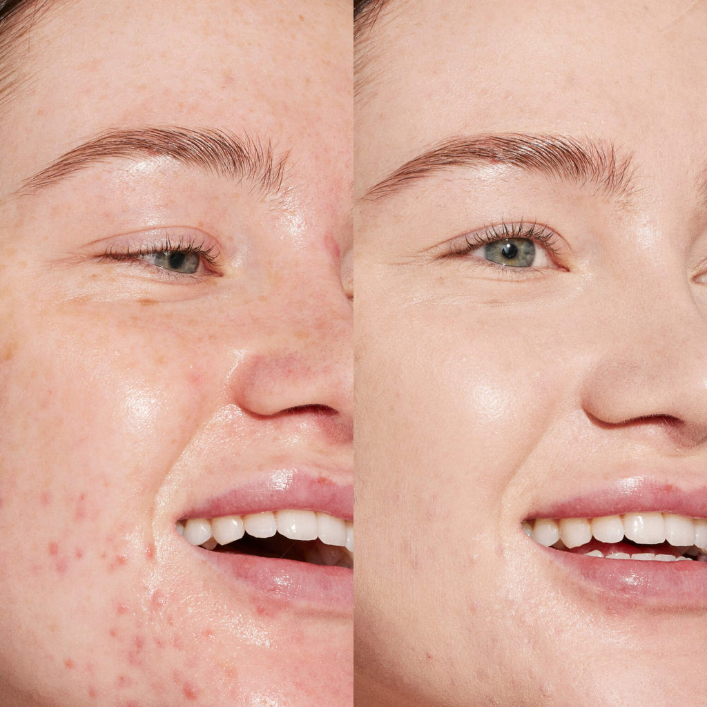 Swipe Serum Concealer® H0